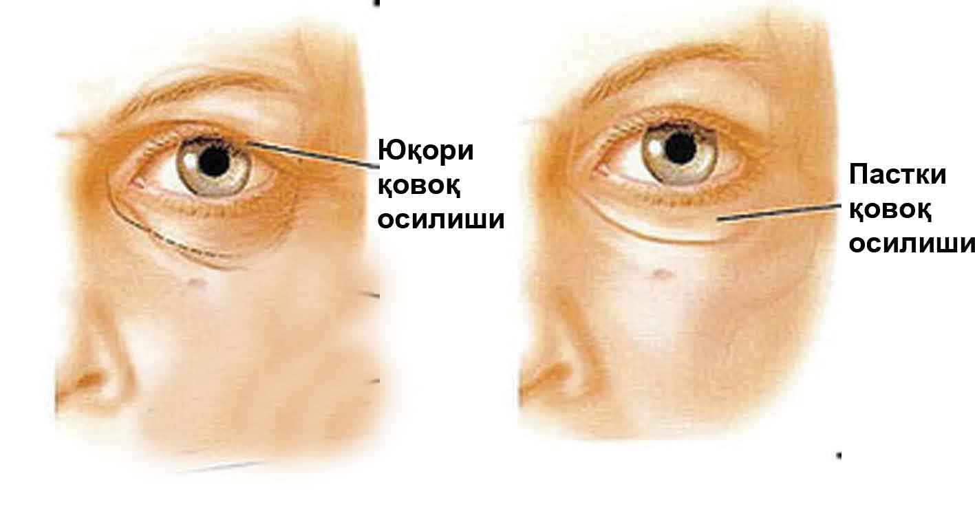 ҚОВОҚ  ОСИЛСА,  МИЯДА  НУҚСОН  БОР