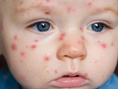 ИССИҚДАН ТОШМА ТОШСА...