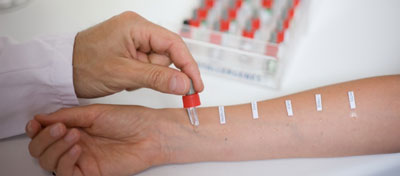 ҚИЗИЛ МЕВА АЛЛЕРГИЯ ЧАҚИРАДИМИ?